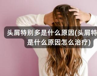 头屑特别多是什么原因(头屑特别多是什么原因怎么治疗)