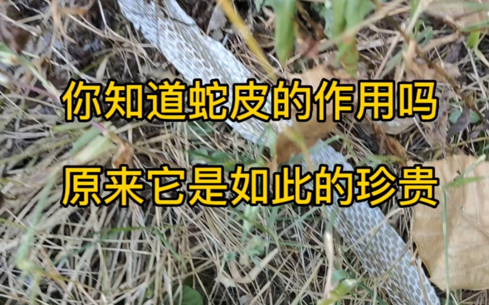 蛇皮的功效与禁忌(蛇皮功效与禁忌，了解一下)